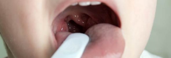 Герпес во рту