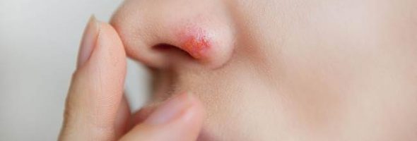 Герпес на носу