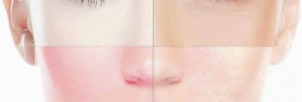 Дерматит на лице